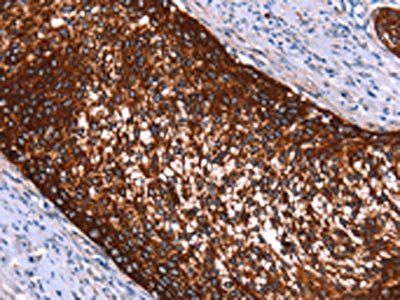 HMGCS2 Antibody