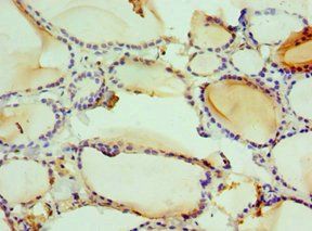 HMGN2 antibody