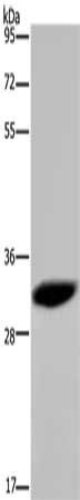 HMGN5 antibody