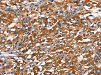 HMMR Antibody