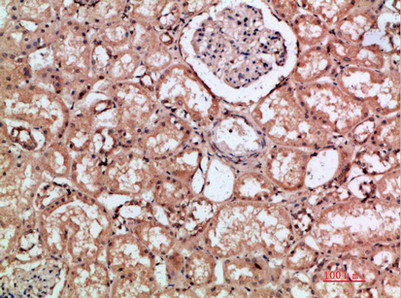 HMMR Antibody