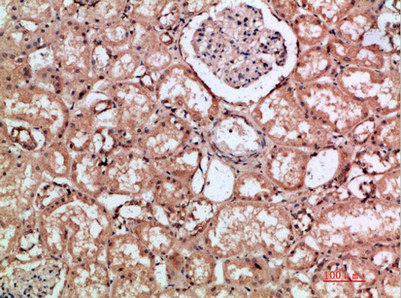 HMMR antibody