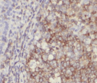 HMMR-Specific antibody