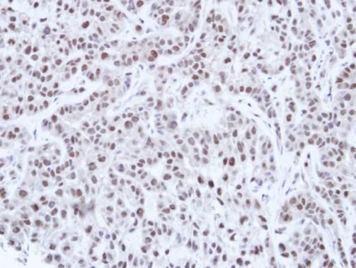 HNF1 alpha antibody