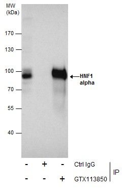 HNF1 alpha antibody