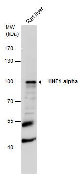 HNF1 alpha antibody