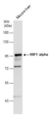 HNF1 alpha antibody