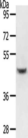 HNF1B Antibody