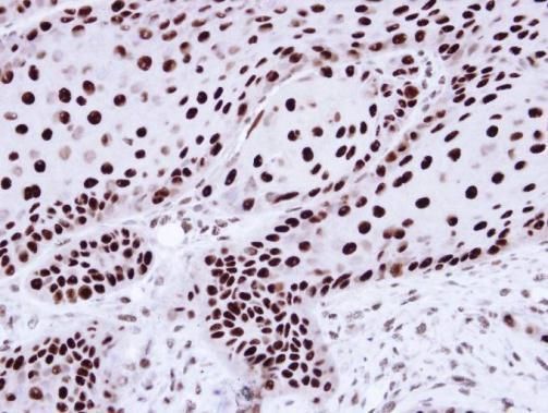 hnRNP C1/C2 antibody