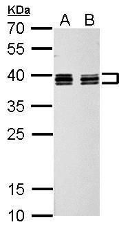 heterogeneous nuclear ribonucleoprotein C (C1/C2) Antibody