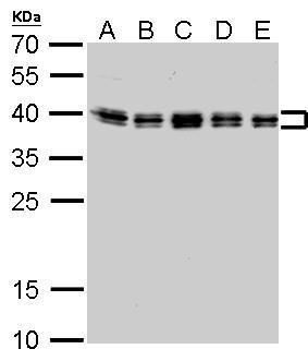 heterogeneous nuclear ribonucleoprotein C (C1/C2) Antibody