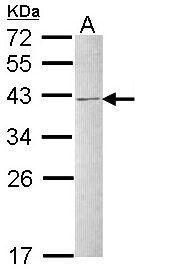 heterogeneous nuclear ribonucleoprotein C (C1/C2) Antibody