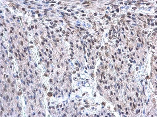 hnRNP F antibody [N1N3]