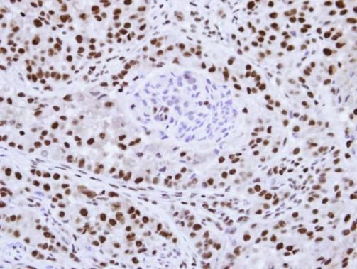 hnRNP F antibody [N1N3]