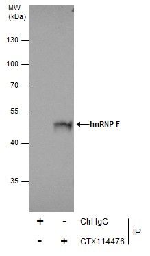 hnRNP F antibody