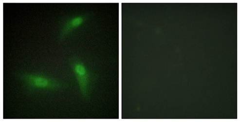 hnRNP A1 Antibody