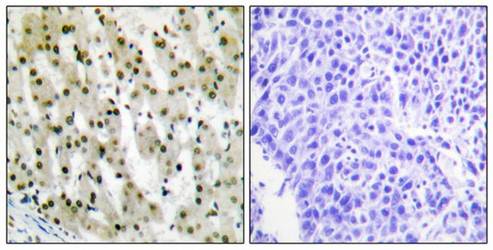 hnRNP A1 Antibody