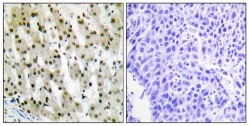 hnRNP A1 antibody