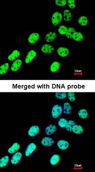 hnRNP F antibody