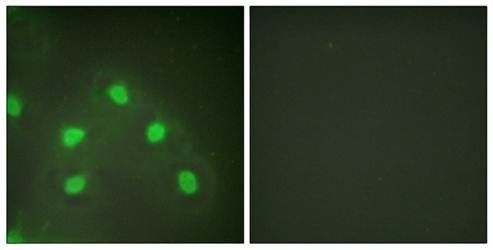 hnRNP L Antibody
