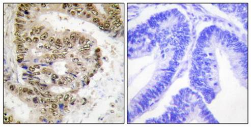 hnRNP L Antibody