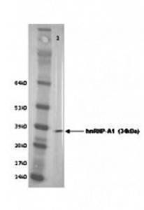 hnRNP A1 Monoclonal Antibody