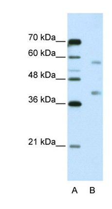 HNRNPA3 antibody