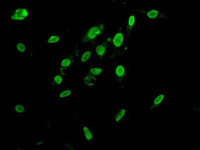 HNRNPAB Antibody
