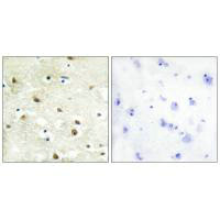 HNRNPC Antibody