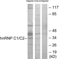 HNRNPC antibody