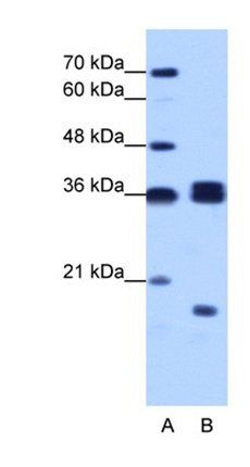 HNRNPH3 antibody