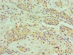 HNRNPM Antibody