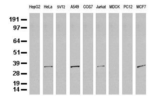 HNRNPH1 Antibody