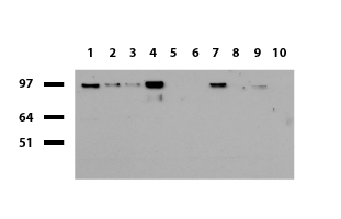 HNRPH1 Antibody