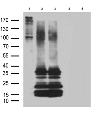 HNRNPH1 Antibody