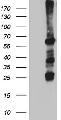 HNRNPH1 Antibody
