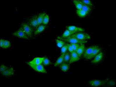HOGA1 Antibody
