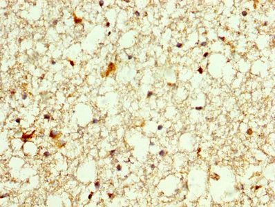 OTX2 Antibody