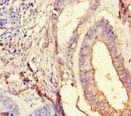 Homeobox protein OTX2 antibody