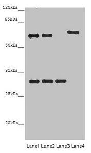 Homeobox protein OTX2 antibody