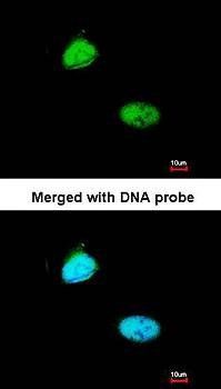 Homeobox-containing protein 1 antibody
