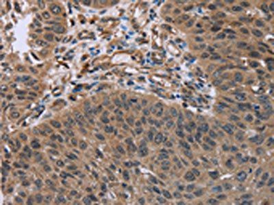 HOMER1 Antibody