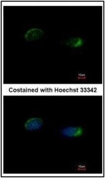 homer scaffold protein 1 Antibody