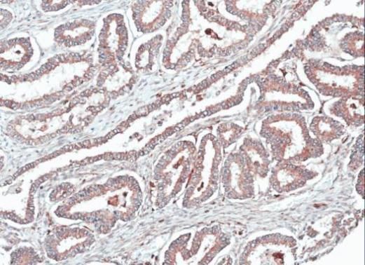 Homer1 antibody