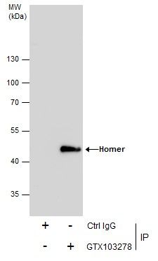 homer scaffold protein 1 Antibody