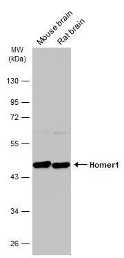 homer scaffold protein 1 Antibody