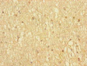 HOMER3 Antibody