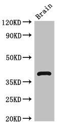 HOMER3 Antibody