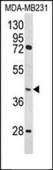HOMER3 antibody