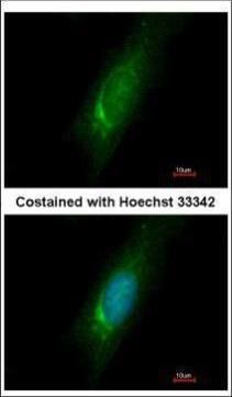 HOMER3 antibody